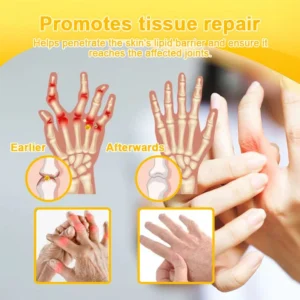 Alternative view of NATRAVOR® Botulinum Toxin & Bee Venom Joint Pain Relief
