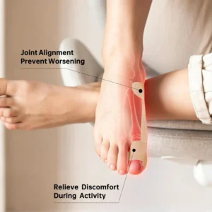🏅Natravor® Relief Botanical Bunion Comfort Patcht👠💃