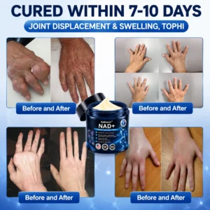 Official Store: 🦵𝐍𝐚𝐭𝐫𝐚𝐯𝐨𝐫™ NAD+ Advanced Anti-Aging Joint Relief Cream
– US Store