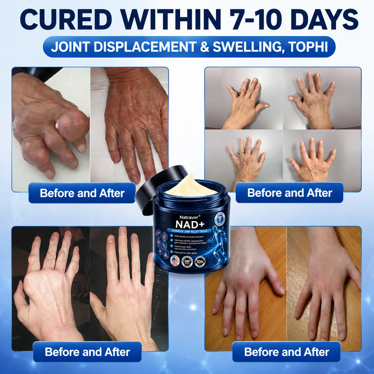 Official Store: 🦵𝐍𝐚𝐭𝐫𝐚𝐯𝐨𝐫™ NAD+ Advanced Anti-Aging Joint Relief Cream
– US Store