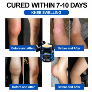 Official Store: 🦵𝐍𝐚𝐭𝐫𝐚𝐯𝐨𝐫™ NAD+ Advanced Anti-Aging Joint Relief Cream
– US Store