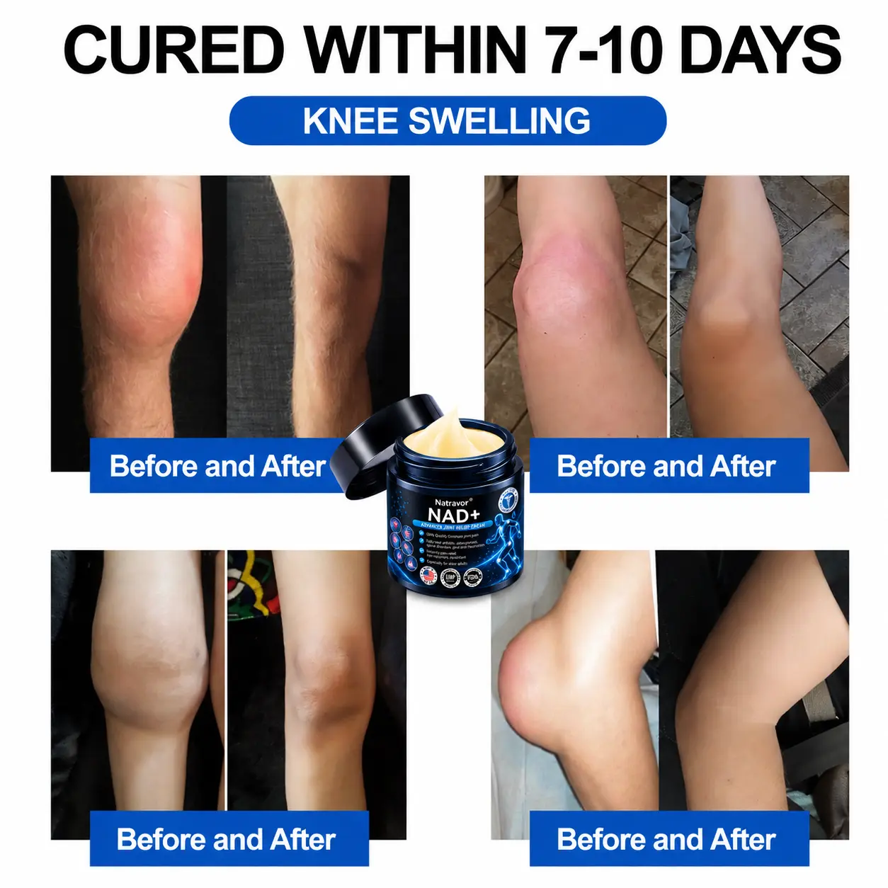 Official Store: 🦵𝐍𝐚𝐭𝐫𝐚𝐯𝐨𝐫™ NAD+ Advanced Anti-Aging Joint Relief Cream
– US Store