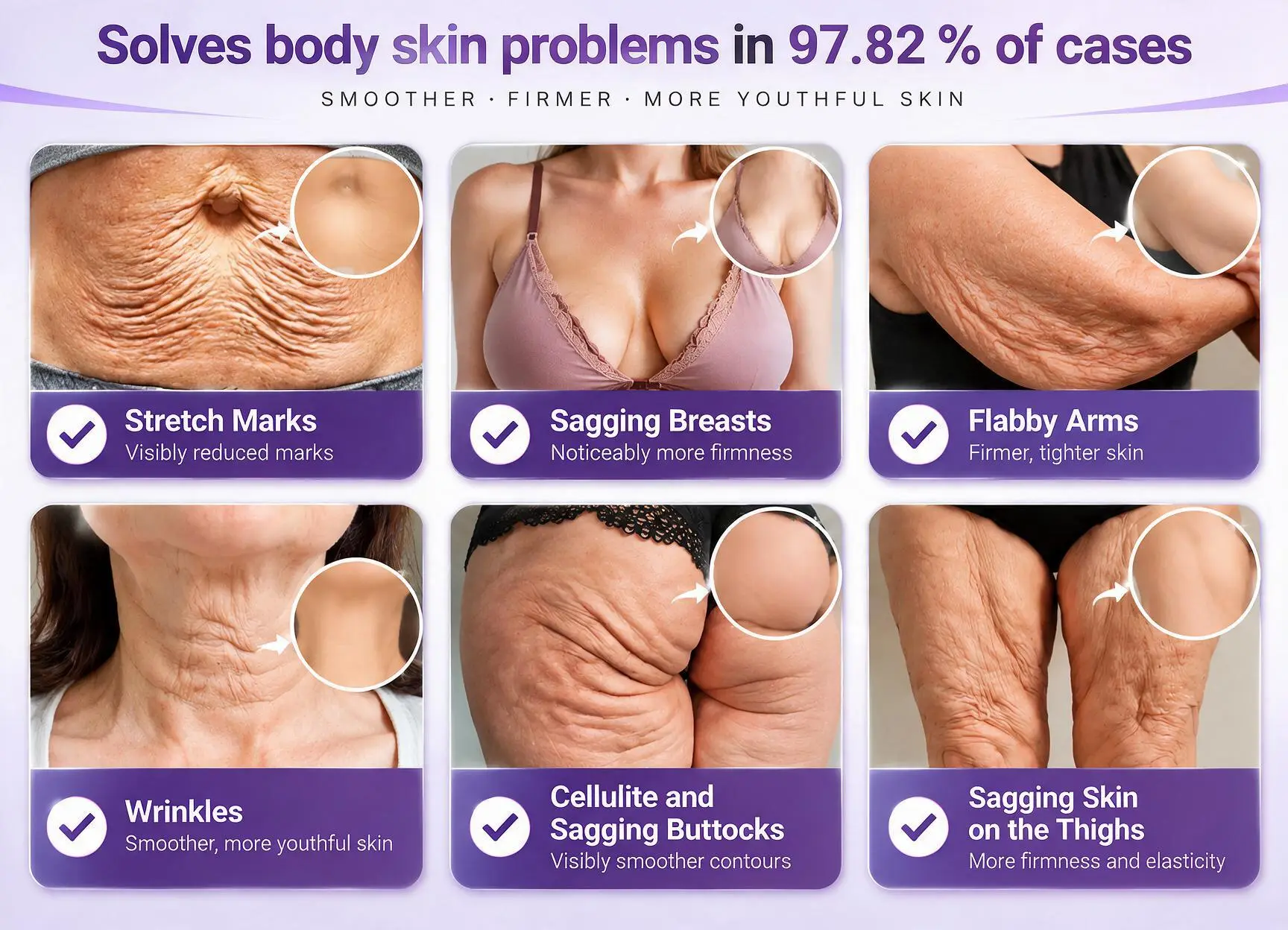 Natravor® PDRN Multi-Peptide Firming Body Cream