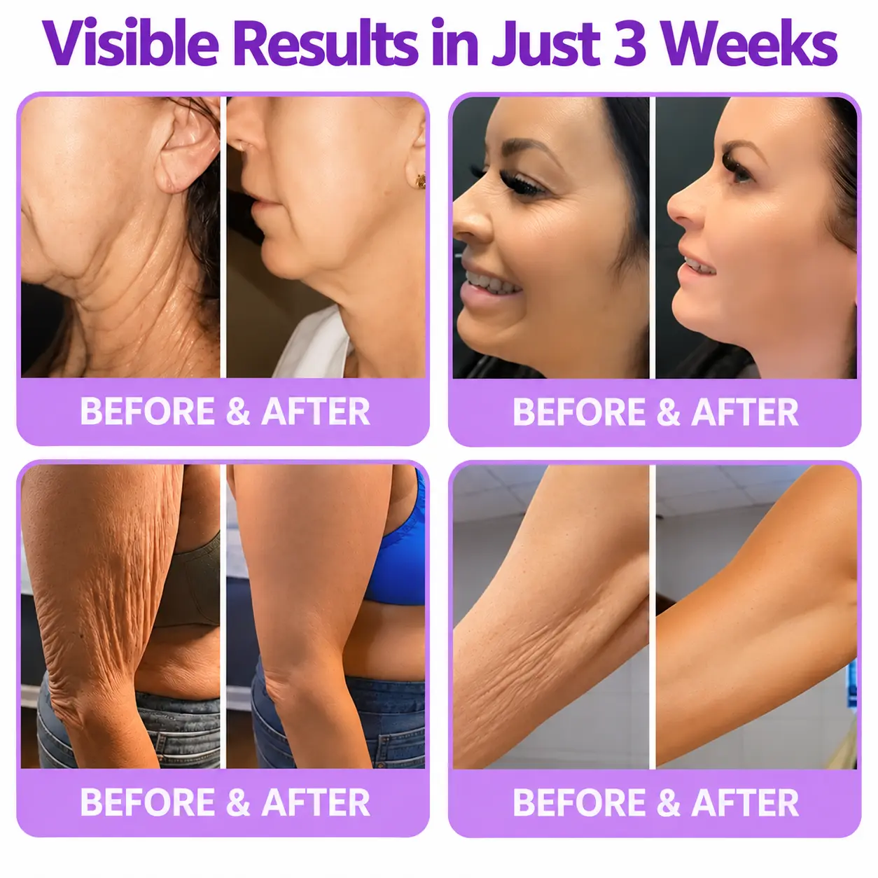 Natravor® PDRN Multi-Peptide Firming Body Cream